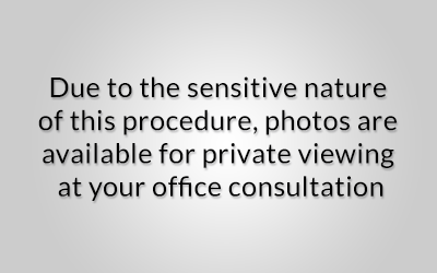sensitive-photos